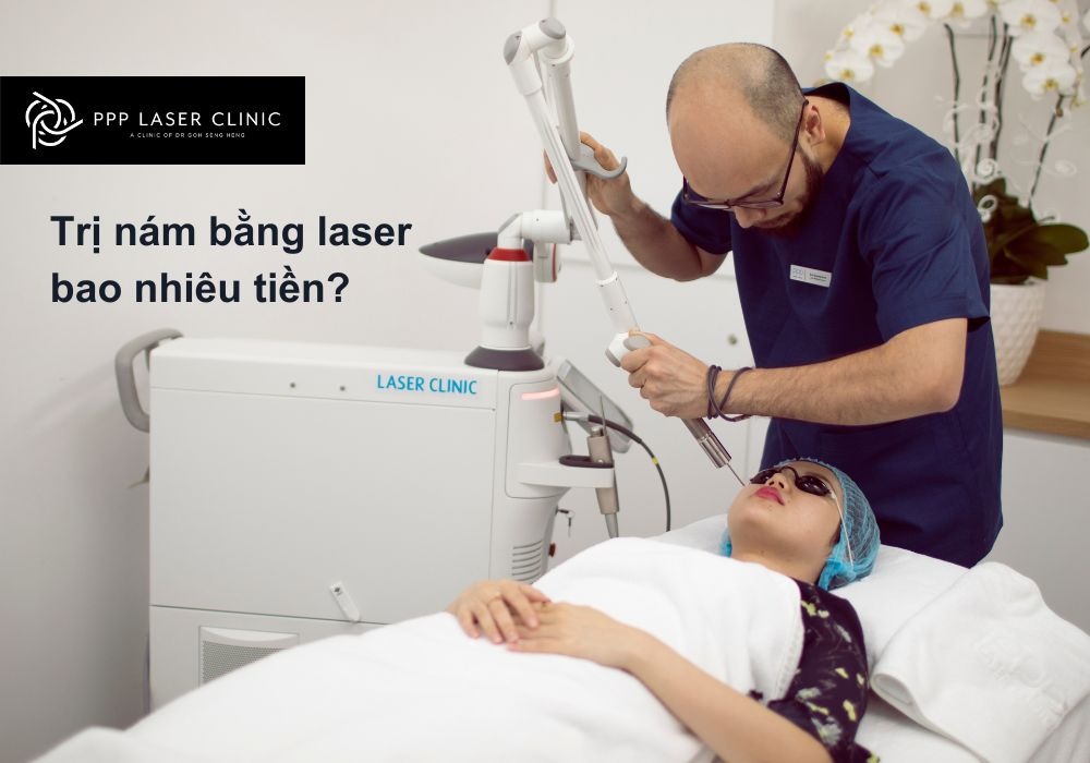 Trị nám bằng laser bao nhiêu tiền